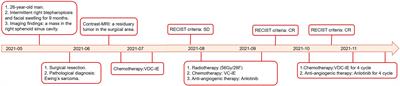 Primary Ewing’s sarcoma of sphenoid sinus: A case report and literature review